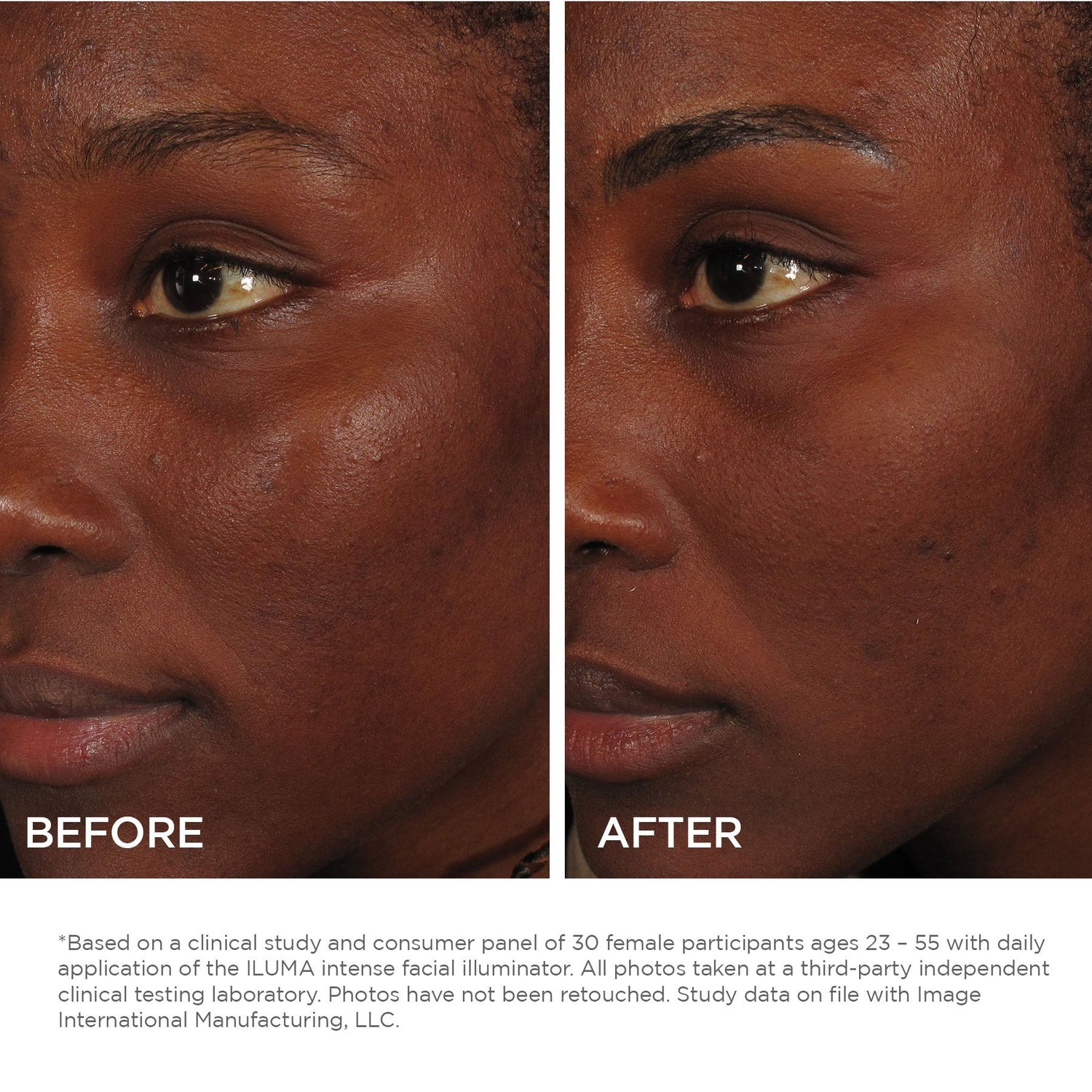 Image Skincare ILUMA Intense Facial Illuminator 1oz