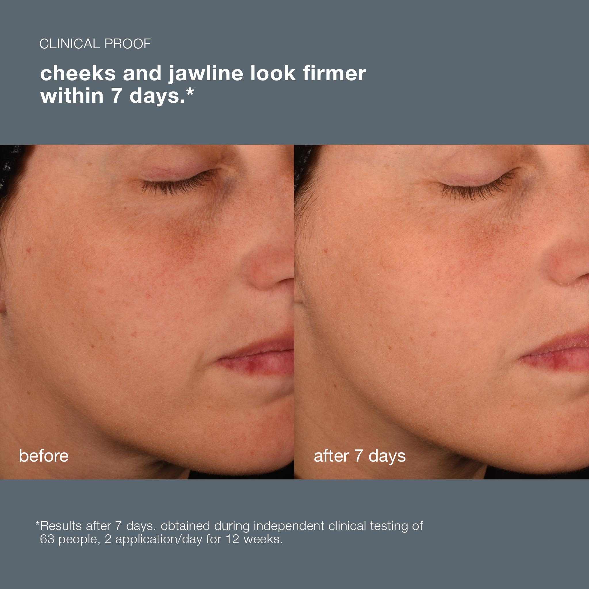 pro-collagen banking serum