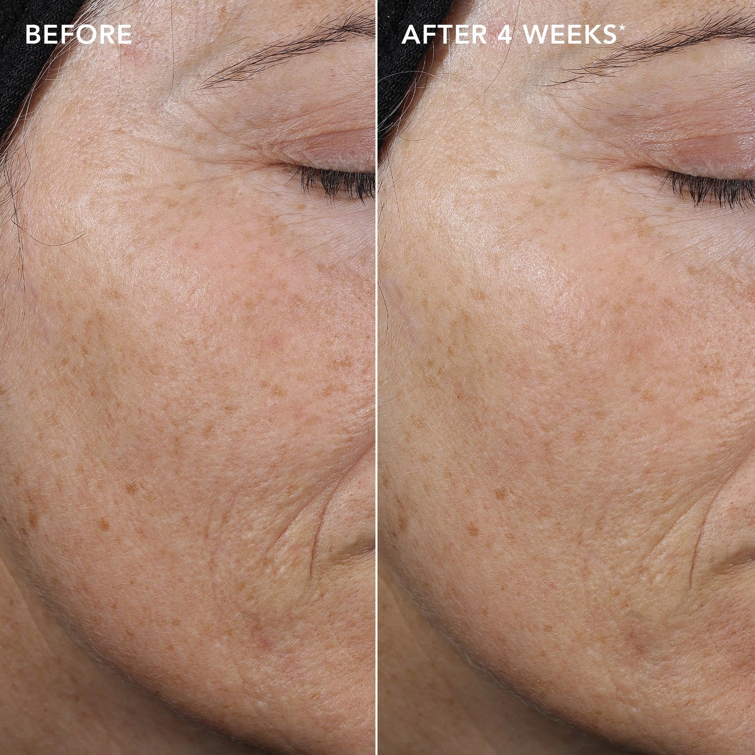 AGELESS+ retinol pure liquid retinol 0.3% (samples 5-pack)
