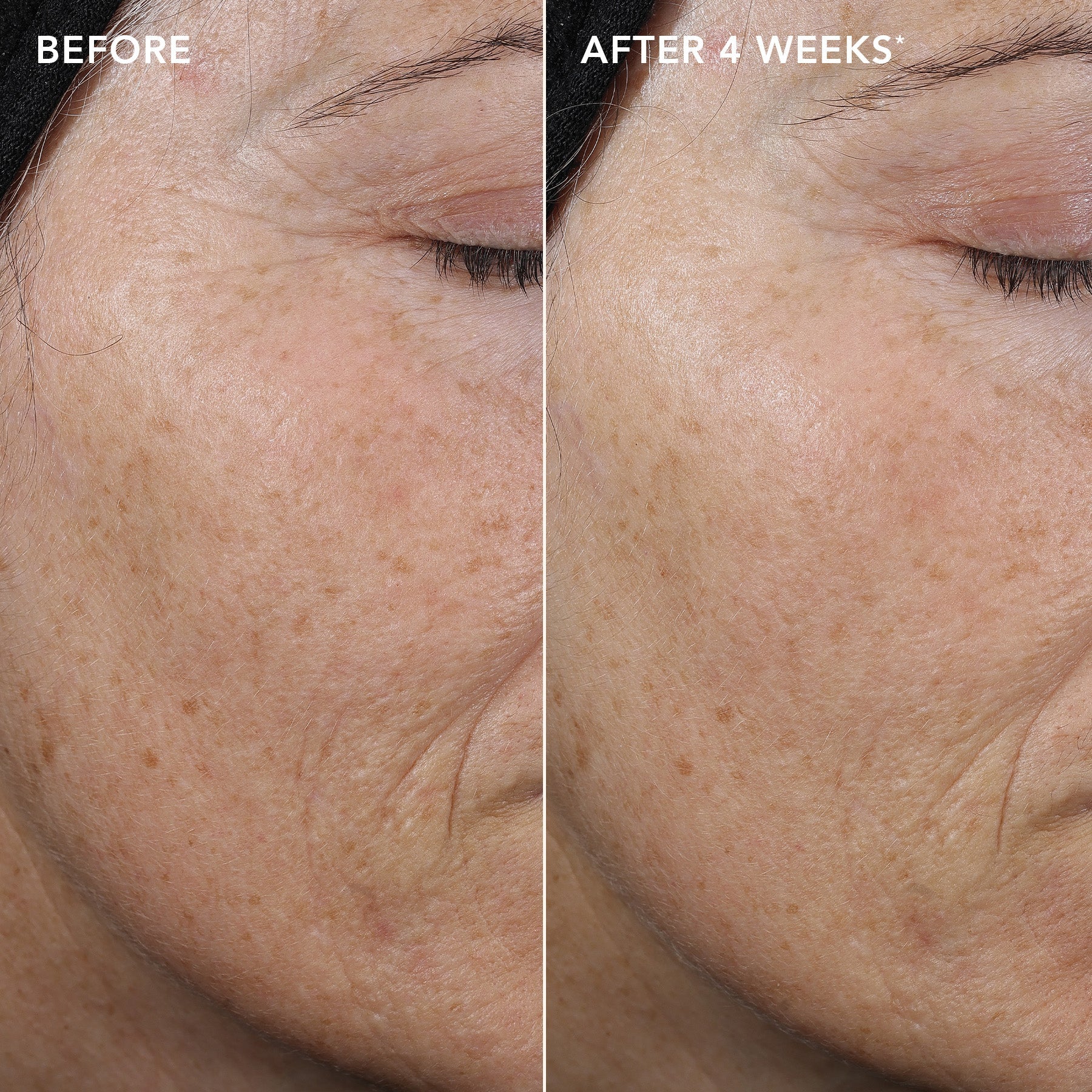 AGELESS+ retinol pure liquid retinol 0.3% (samples 5-pack)