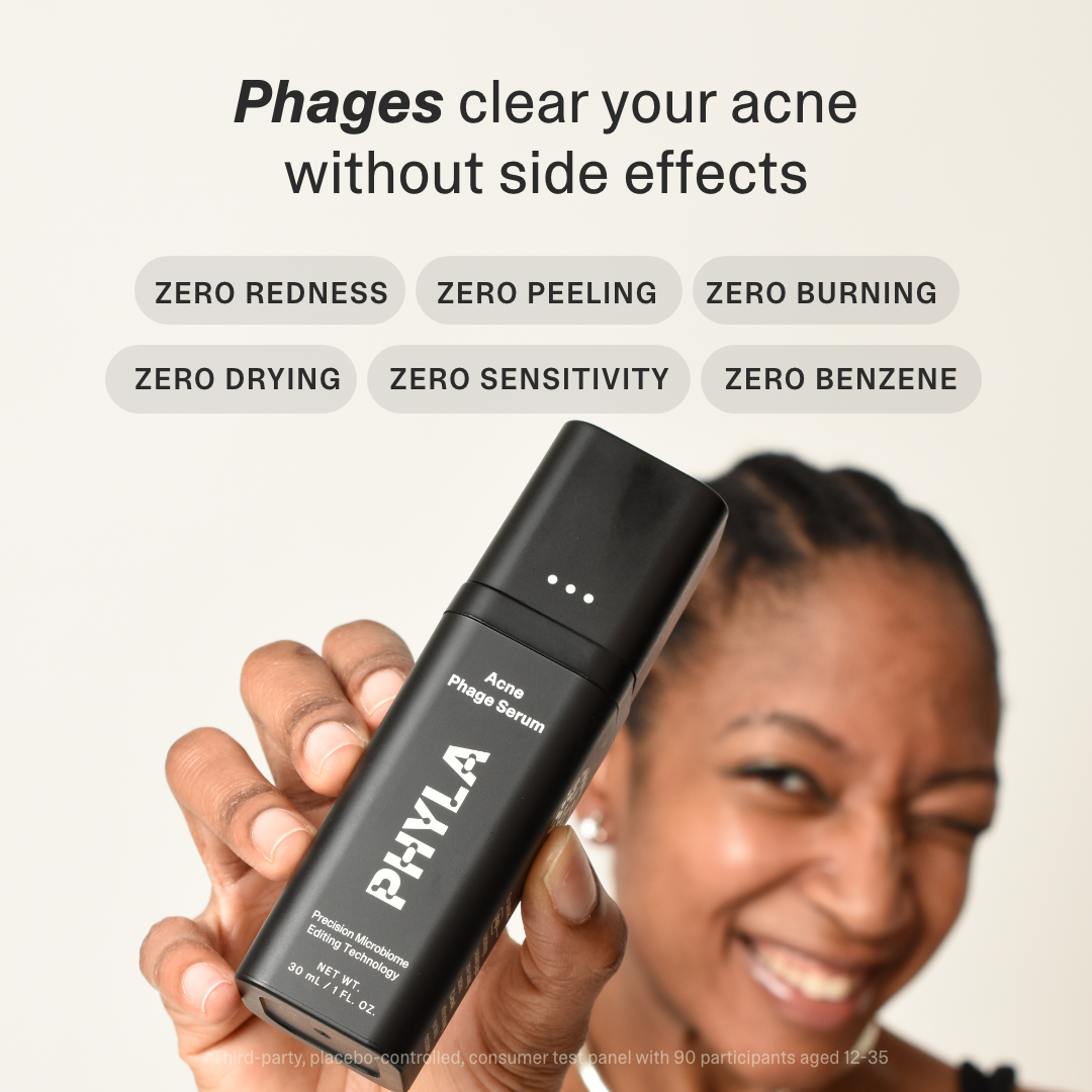 Acne Phage Serum
