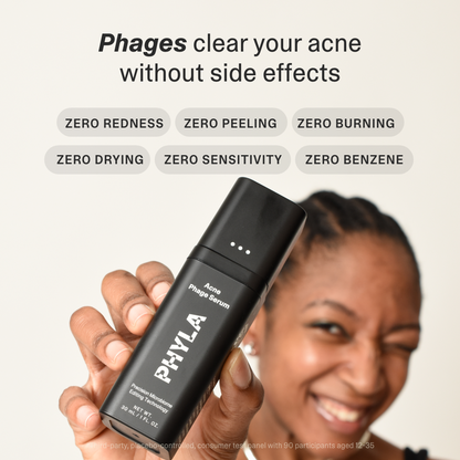 Acne Phage Serum