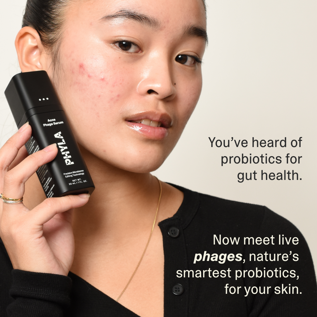 Acne Phage Serum
