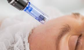 Advanced Microneedling Certification Course